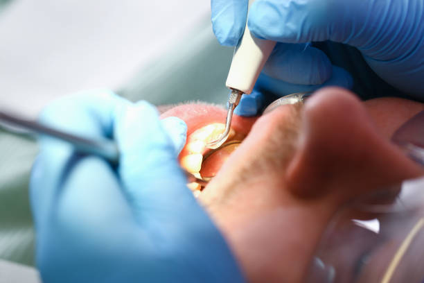 Best Orthodontic Emergency Dentist in Diboll, TX