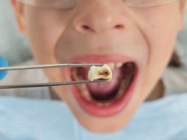 Best Pediatric Emergency Dentist in Diboll, TX